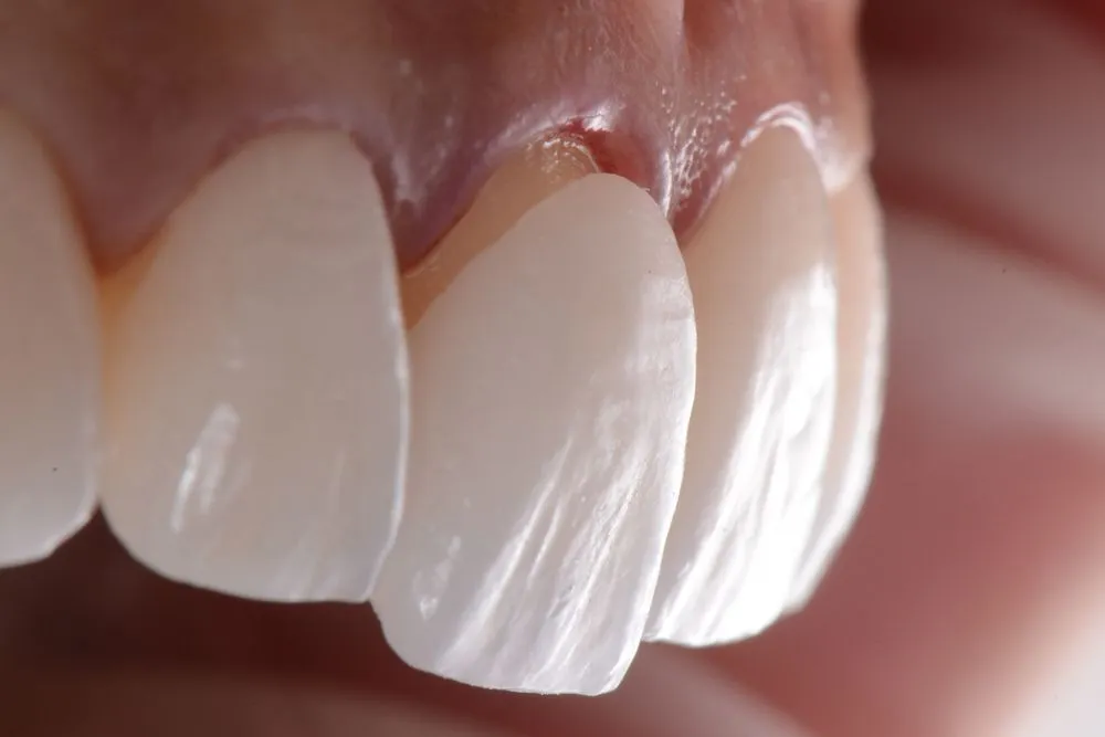 Cosmetic Dentistry Service - Aesthetic dental treatments at Klinik Pergigian Razz